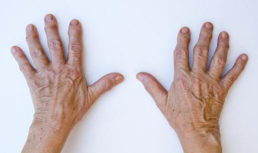 People with arthritis in their hands may appreciate power windows.
